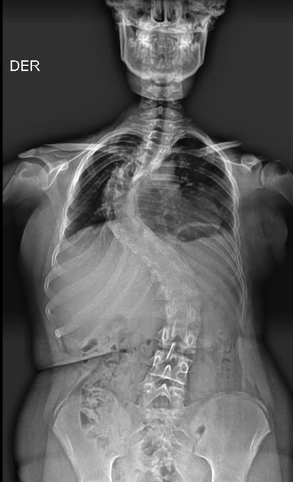 Imagen de columna